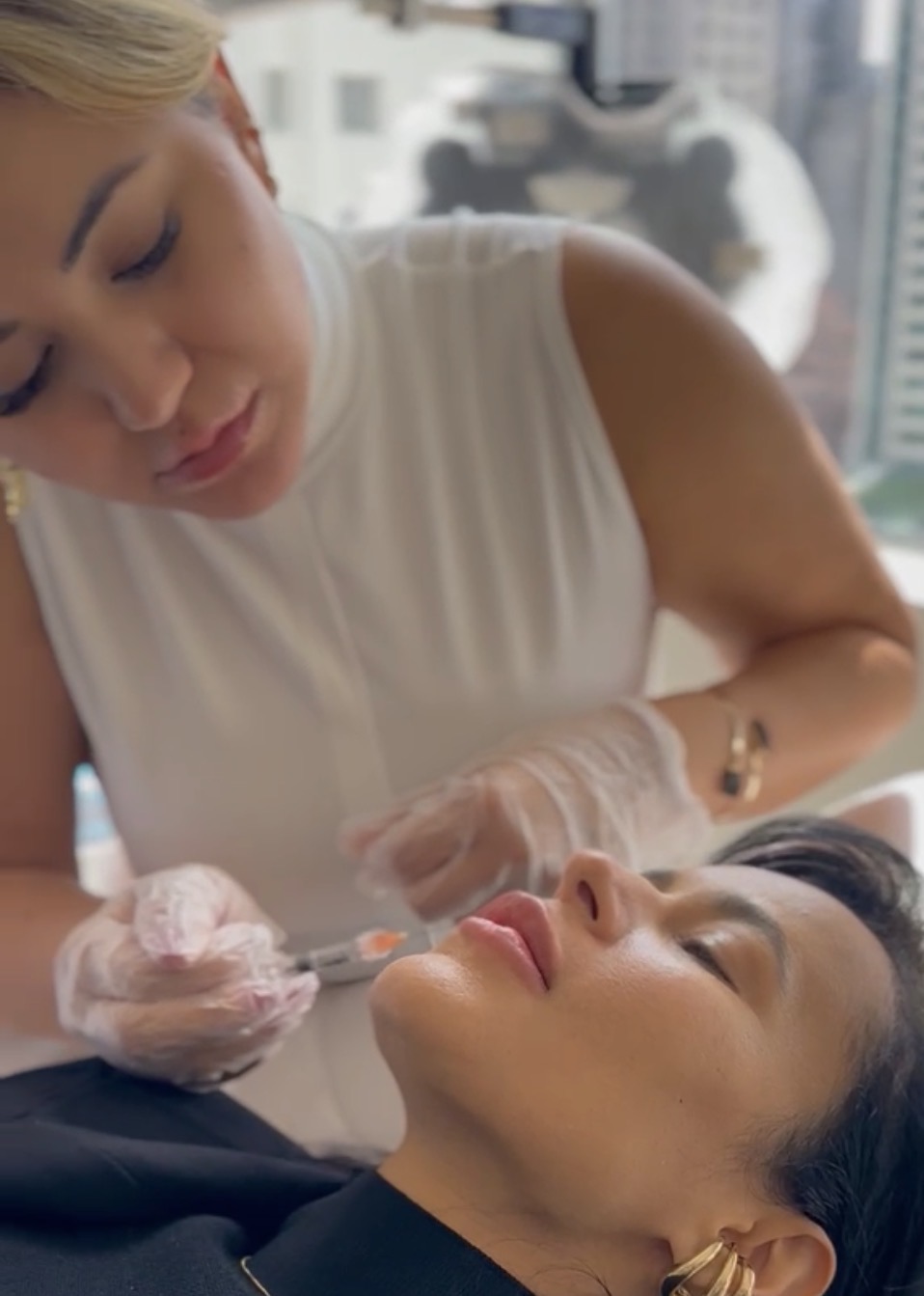 Preenchimento labial em atendimento